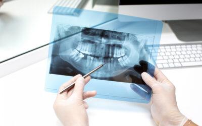 Revisión dental en Vitoria: qué incluye y por qué no deberías saltártela