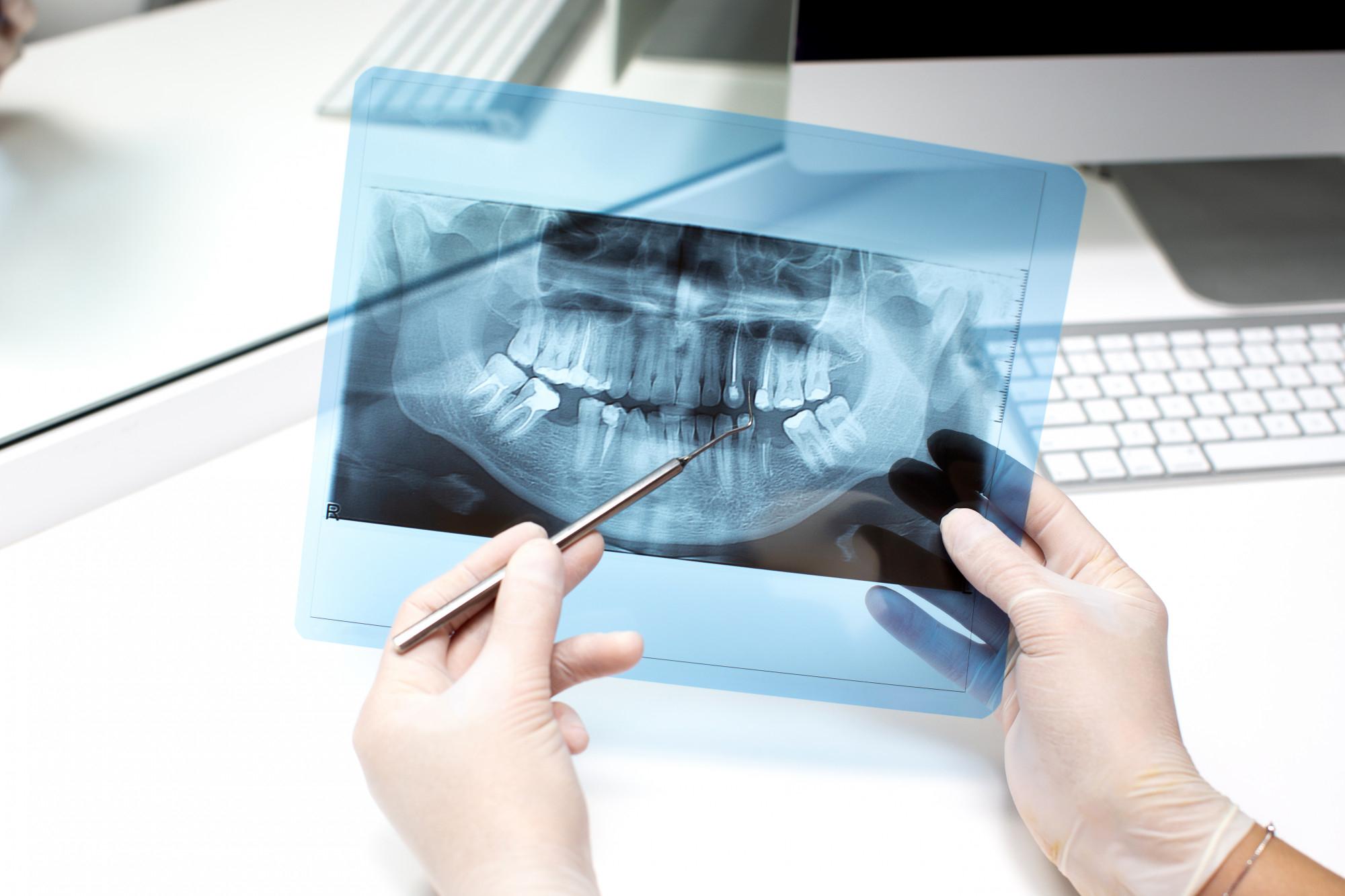 Revisión dental en Vitoria — chequeo dental completo en clínica Gazdent Salburua