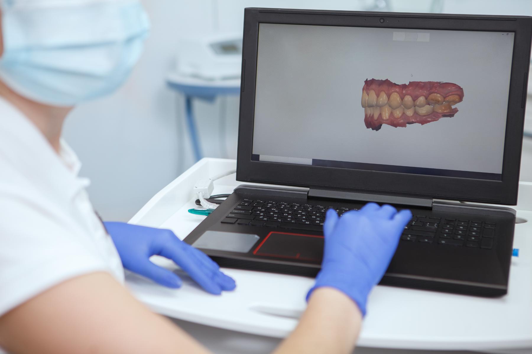escaner intraoral vitoria